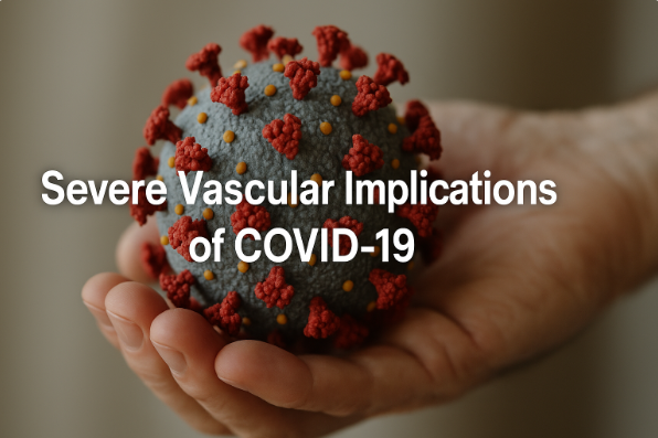 Severe Vascular Implications of COVID-19 Introduction: Beyond the Lungs